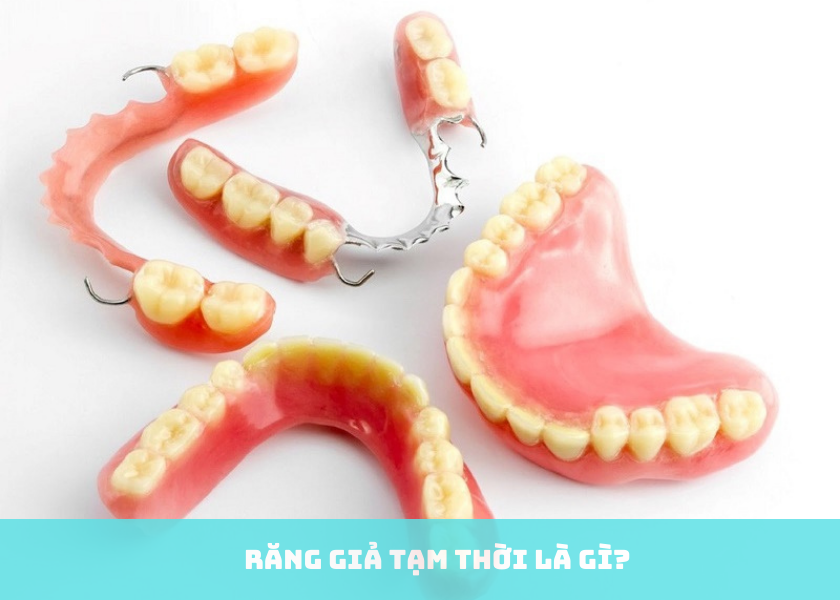 Các loại răng giả cố định hiện nay