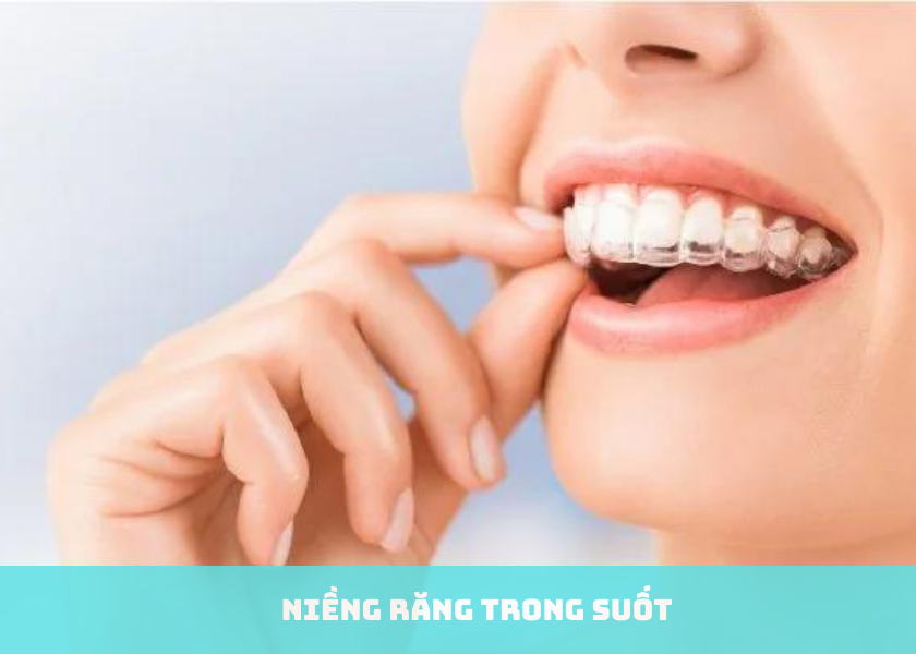 Niềng răng trong suốt có đau nhức không?