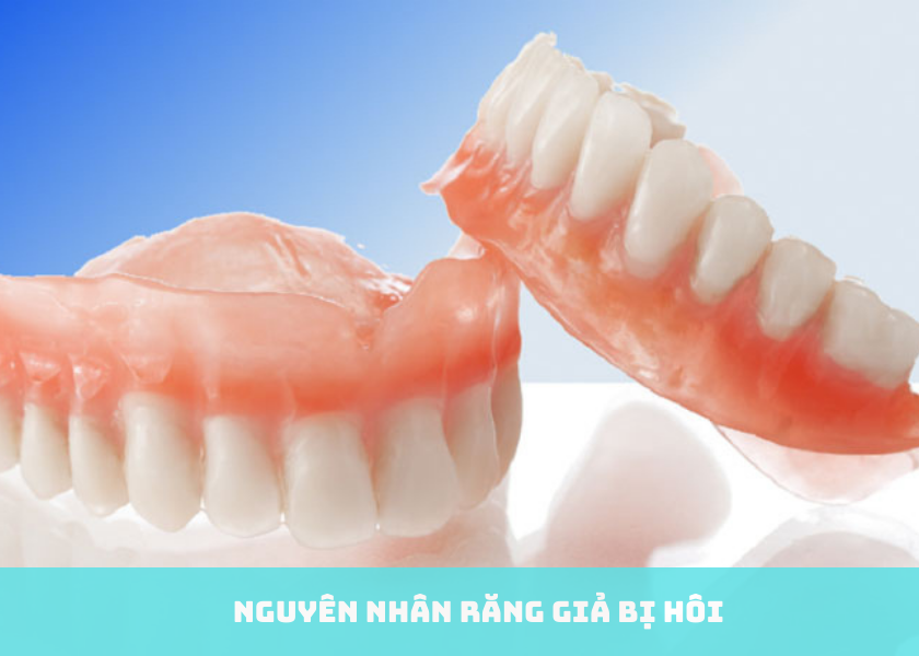 Nguyên nhân răng giả bị hôi