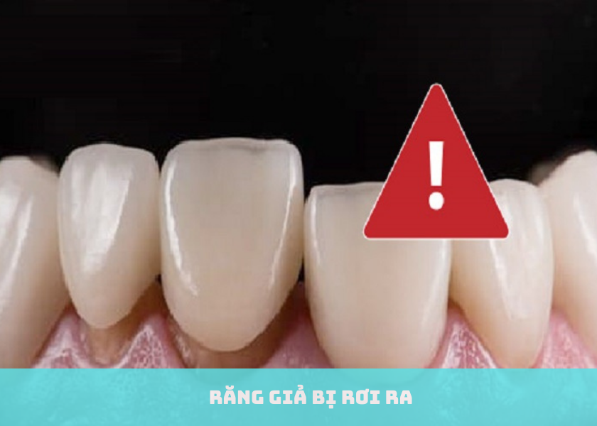 Tips chăm sóc răng giả tránh bị rơi ra