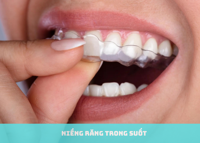 Niềng răng trong suốt có đau nhức không? 