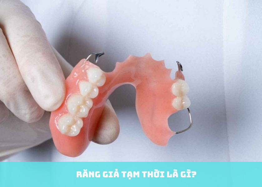 Những trường hợp nào nên gắn răng tạm và răng giả cố định?