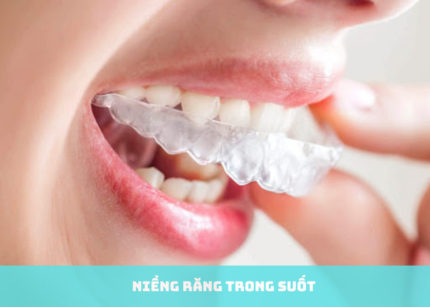 Niềng răng trong suốt có đau nhức không?