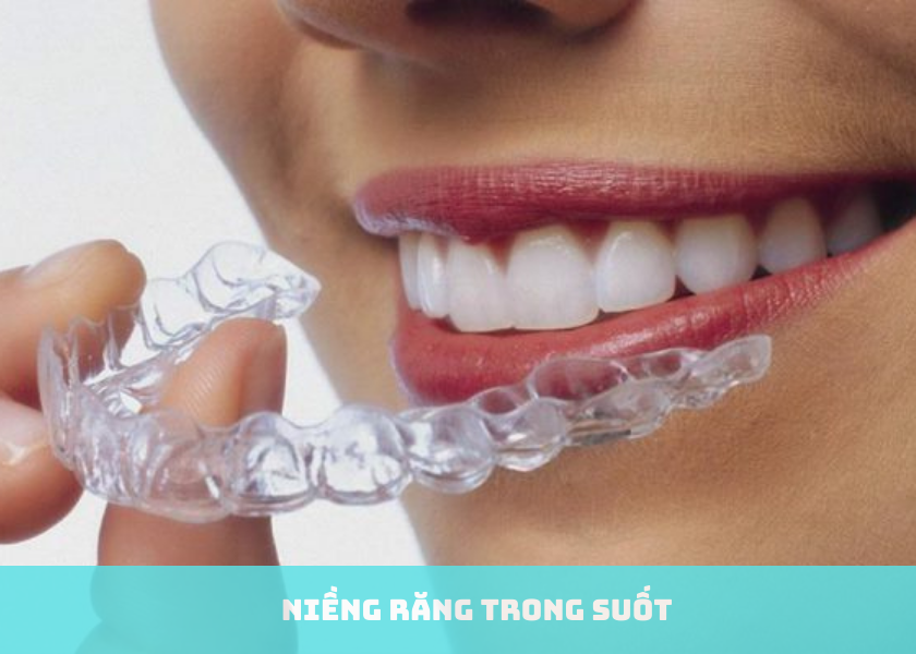 Niềng răng trong suốt là gì?