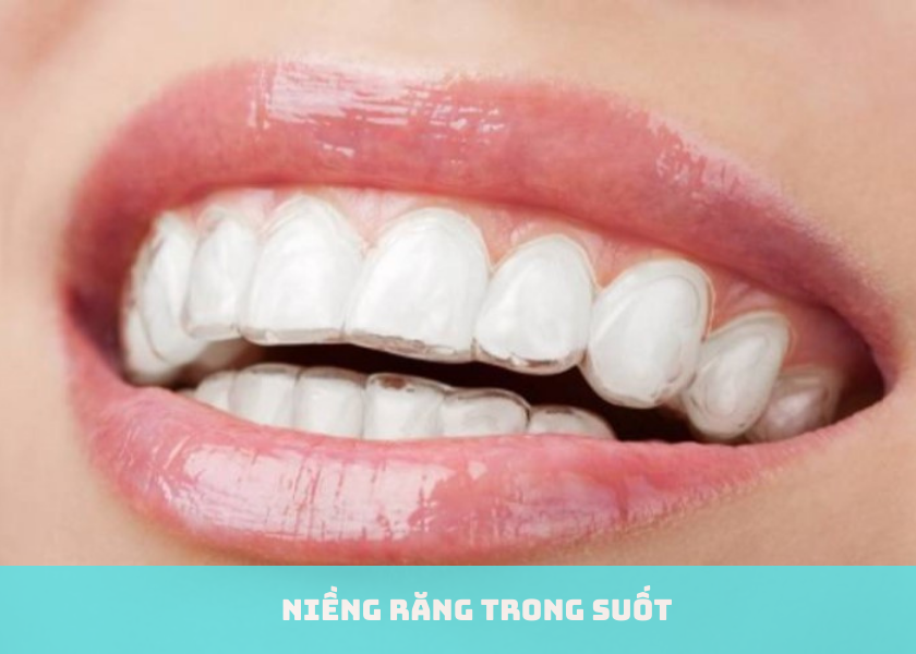 Niềng răng trong suốt có đau nhức không?