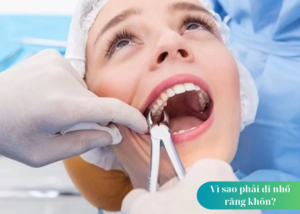 Chăm sóc răng sau khi nhổ răng khôn. Thời điểm thích hợp nhổ răng khôn và không nên nhổ răng khôn khi nào?