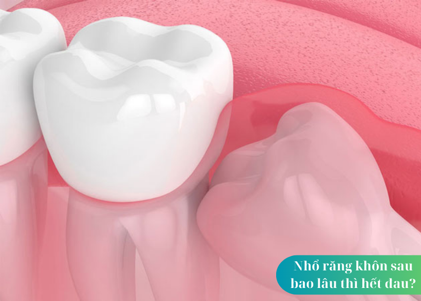 Mọc răng khôn hàm trên có đau đớn không?
