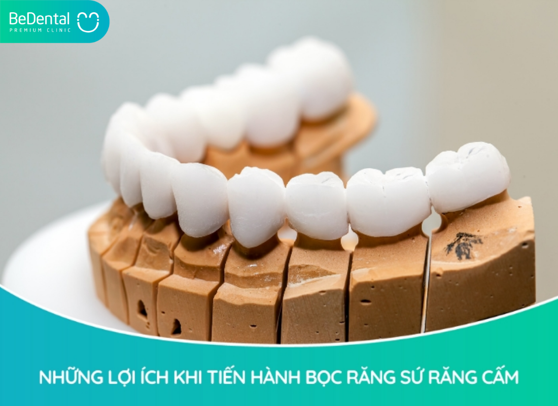 Bọc sứ răng cấm giá bao nhiêu tiền, nên bọc sứ khi nào