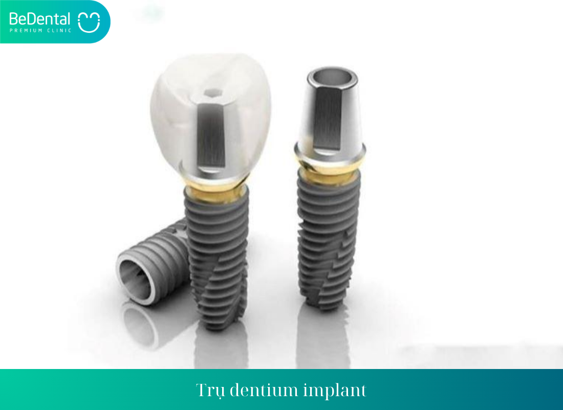 Tru dentium implant