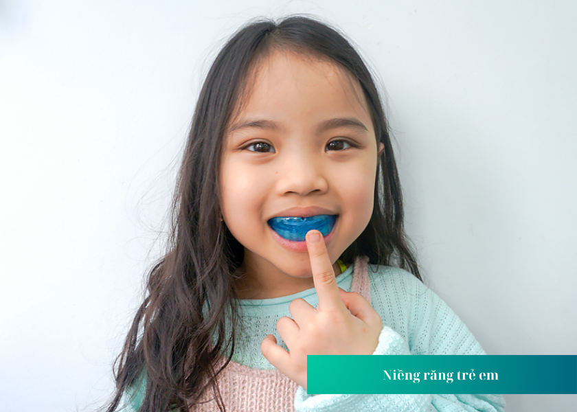 Độ tuổi nào phù hợp nhất để niềng răng cho trẻ em? 