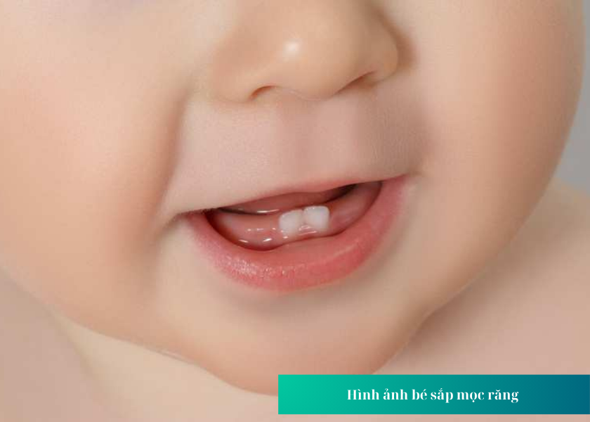 Trẻ bắt đầu mọc răng vào thời điểm nào?