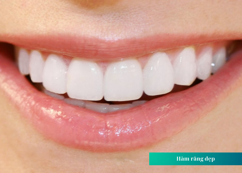 Thế nào là hàm răng đẹp tự nhiên?