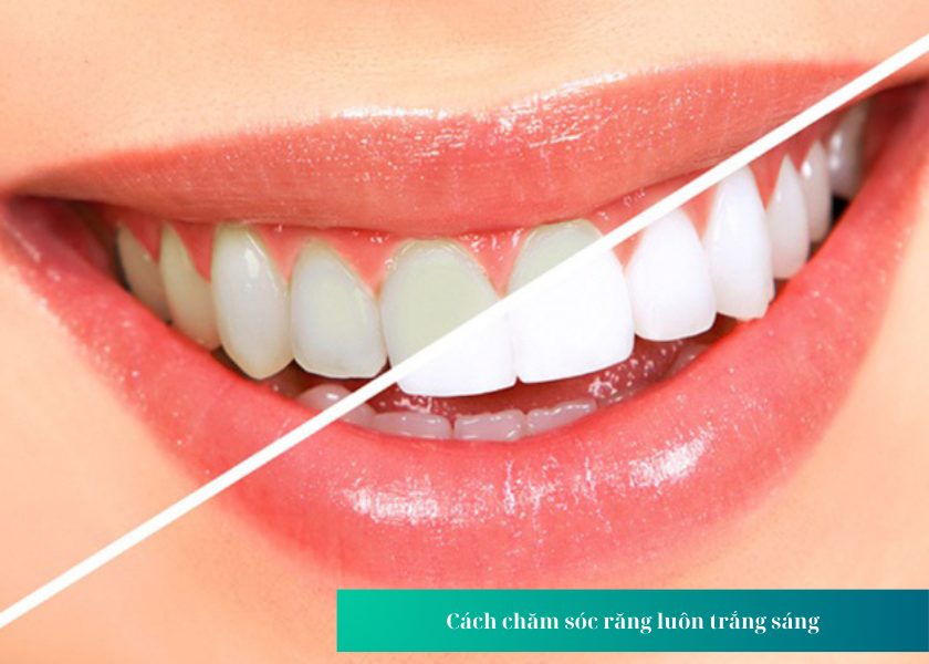 Cách chăm sóc răng luôn trắng sáng