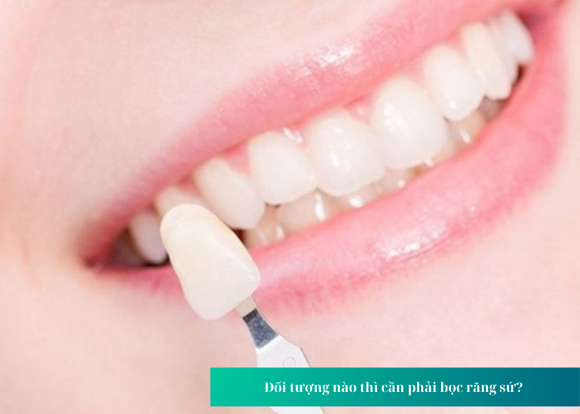 Đối tượng nào thì cần phải bọc răng sứ? 