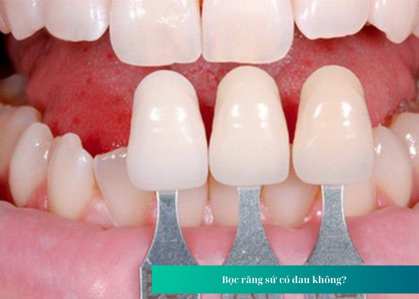 Bọc răng sứ có đau không? 