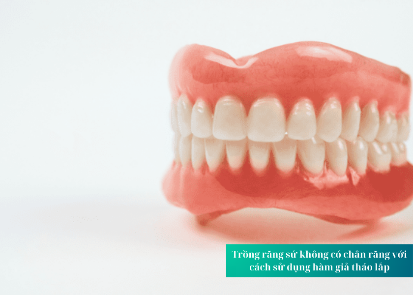 Trồng răng sứ không có chân răng với cách sử dụng hàm giả tháo lắp