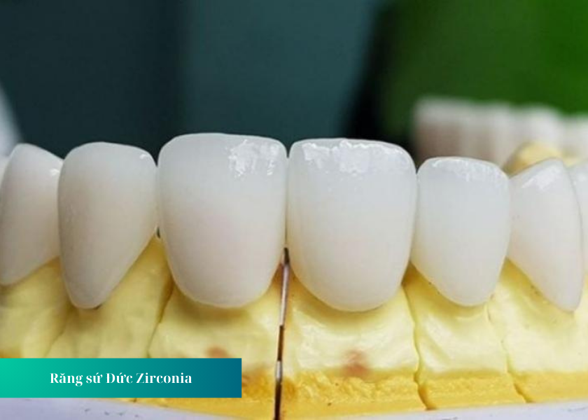 Răng sứ Đức Zirconia là gì