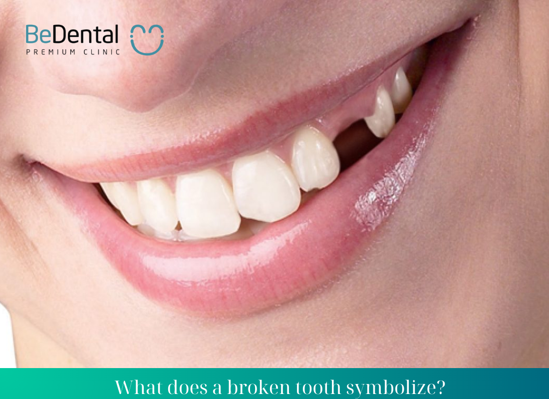 What does a broken tooth symbolize ?