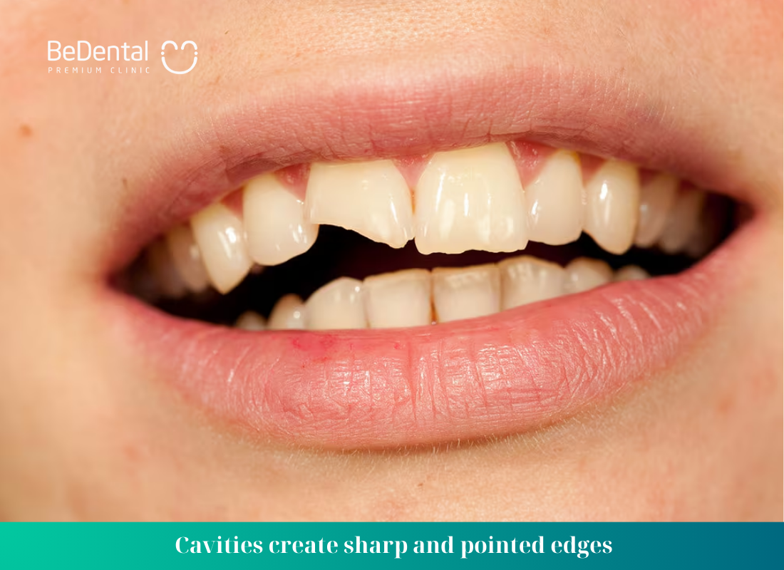 Cavities create sharp and pointed edges