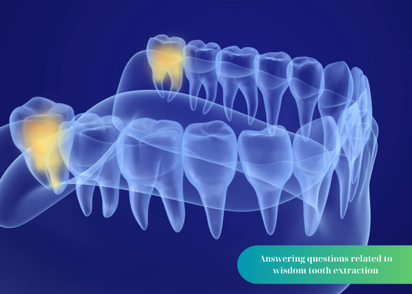 What are wisdom teeth?