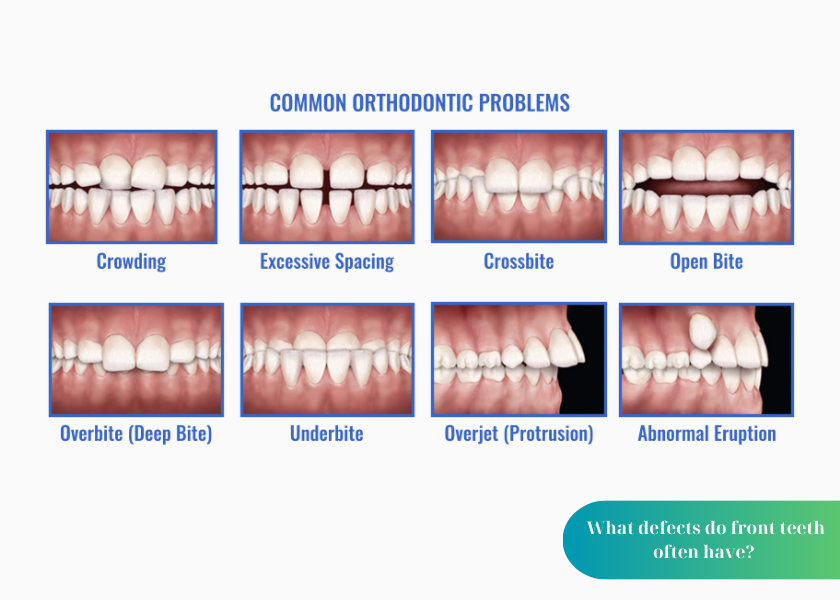 How much does teeth whitening cost 14 2