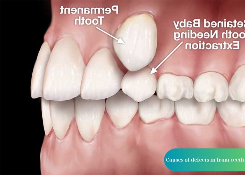 How much does teeth whitening cost 15 1