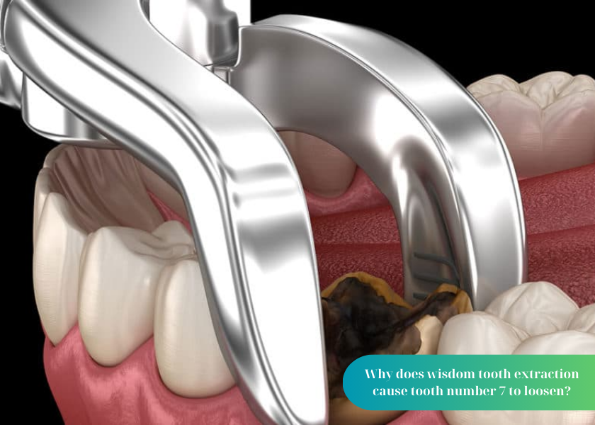 Why does wisdom tooth extraction cause tooth number 7 to loosen?