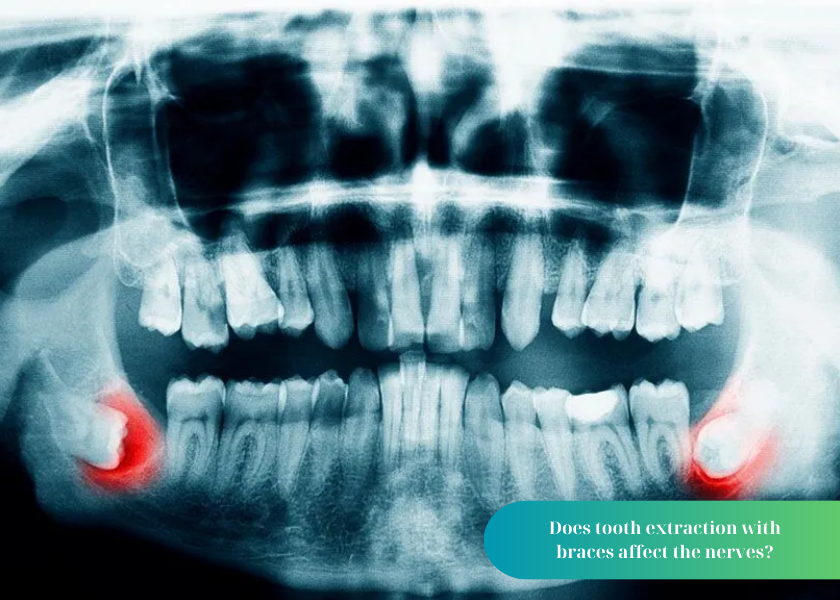 How much does teeth whitening cost 36