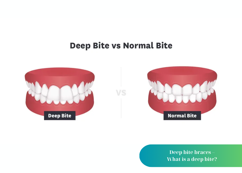 How much does teeth whitening cost 39