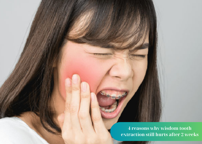 4 reasons why wisdom tooth extraction still hurts after 2 weeks