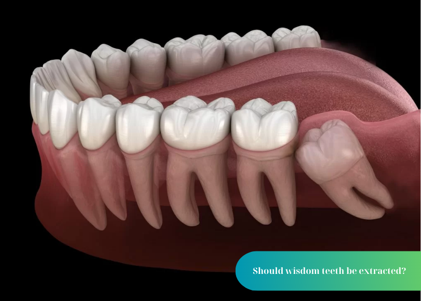 How much does teeth whitening cost 6