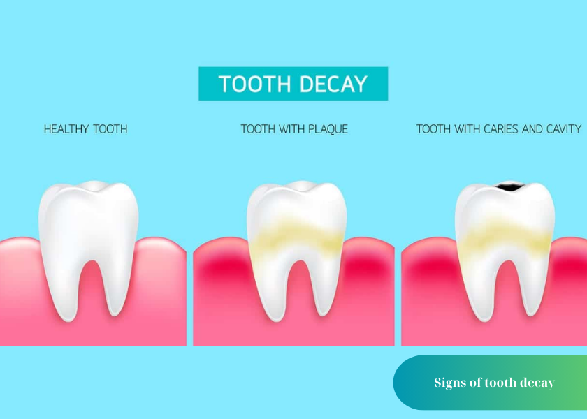 How much does teeth whitening cost 13