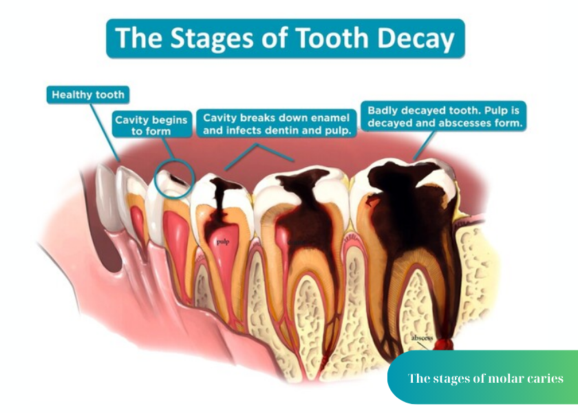 How much does teeth whitening cost 9 1