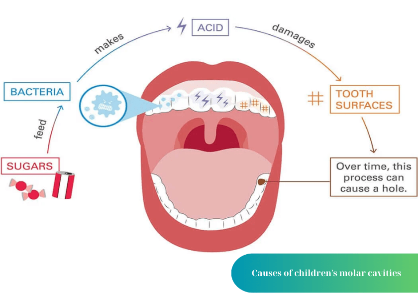 How much does teeth whitening cost 2 min 11