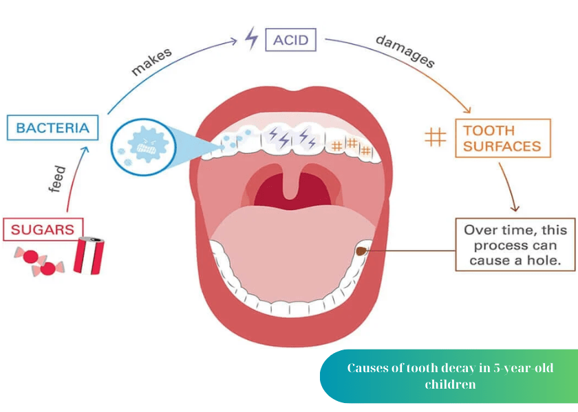 How much does teeth whitening cost 5 min 4