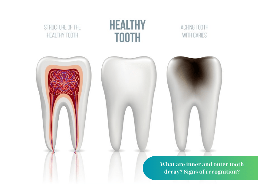 How much does teeth whitening cost 8 min