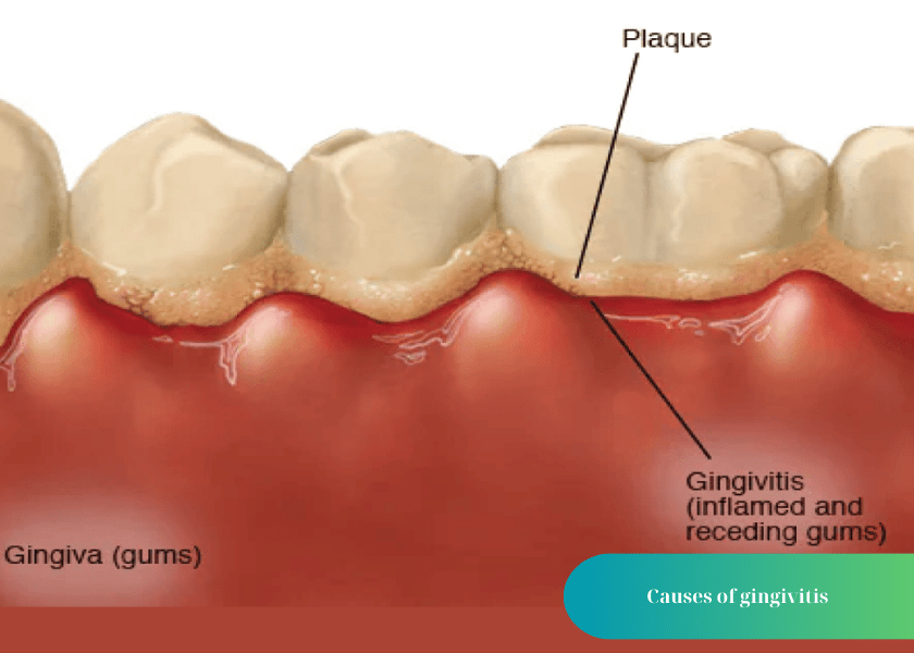 How much does teeth whitening cost 9 min 2