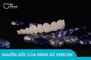 răng sứ cercon