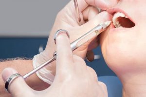 Bạn sẽ không cảm giác đau đớn hay khó chịu khi khâu vết thương sâu nhổ răng Bạn sẽ không cảm giác đau đớn hay khó chịu khi khâu vết thương sâu nhổ răng