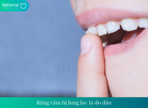 Rang cam bi lung lay la do dau