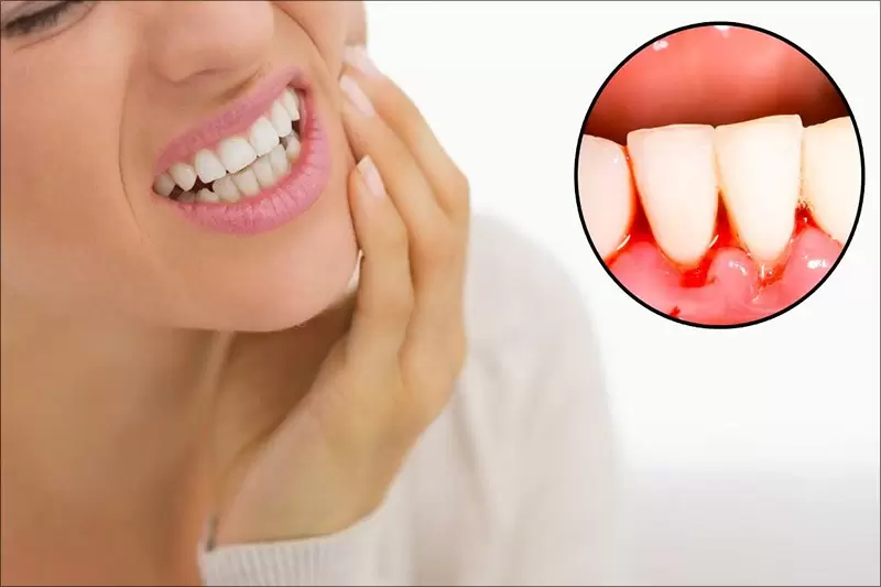 Những biến chứng nguy hiểm khi không nhổ răng số 8