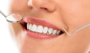 Có hai phương pháp đính đá răng sứ phổ biến