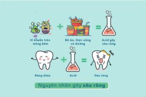 điều trị sâu răng hiệu quả