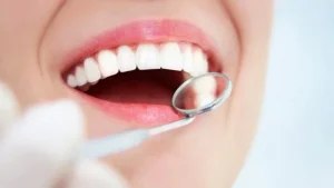 Có nhiều loại răng tạm để bạn chọn lựa
