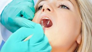 Nhổ răng khôn có nguy hiểm không phụ thuộc vào nhiều yếu tố