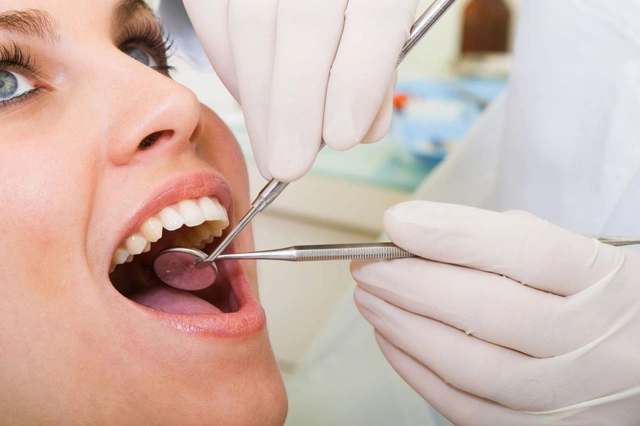 Một số bệnh lý làm vết thương sau khi nhổ răng khôn không cầm máu được