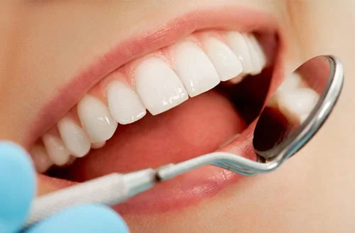 Cầu răng cũ sứ hỏng cần phải làm gì?Nguyên nhân cầu răng hỏng