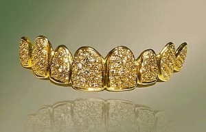BeDental – Địa chỉ nha khoa uy tín trồng răng kim cương giả, răng vàng giả và răng giả titan