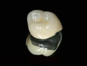 Làm răng giả bằng răng sứ kim loại thường