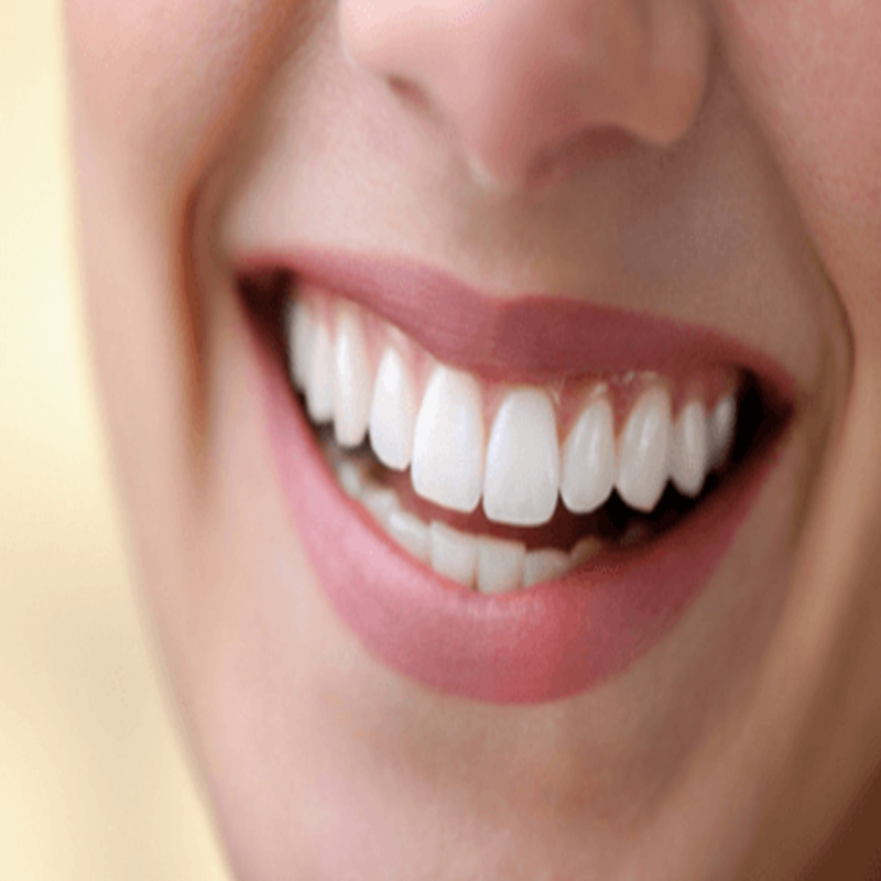 Hàm răng đẹp là như thế nào? 6 tiêu chuẩn của một hàm răng đẹp tự nhiên
